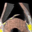 Počítačová tomografie(CT) a robosyntéza